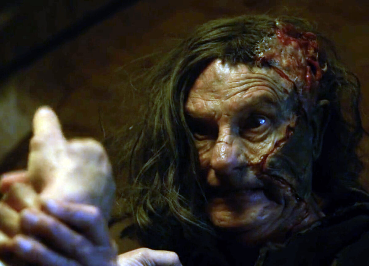 A man with chin length black hair is gripping someones wrist. he has scars of his face and a large open wound on the side of his head 